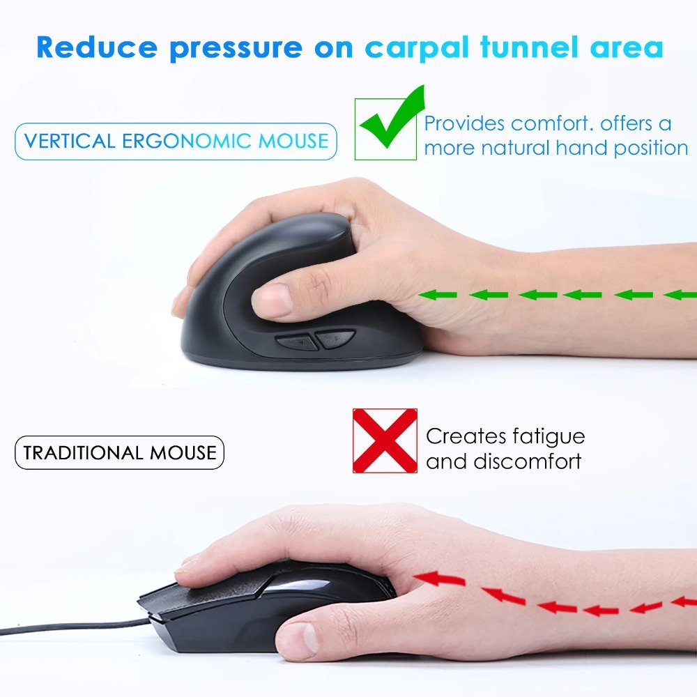เมาส์ไร้สาย 2.4G แนวตั้งตามหลั - Vertical Mouse Left Handed บทวิจารณ์และราคา